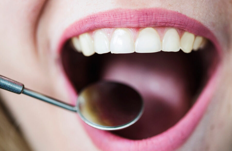 Parodontologia a Bolzano: la Global Dental Care si prende cura delle tue gengive