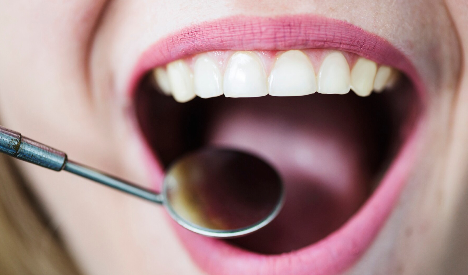 Parodontologia a Bolzano: la Global Dental Care si prende cura delle tue gengive